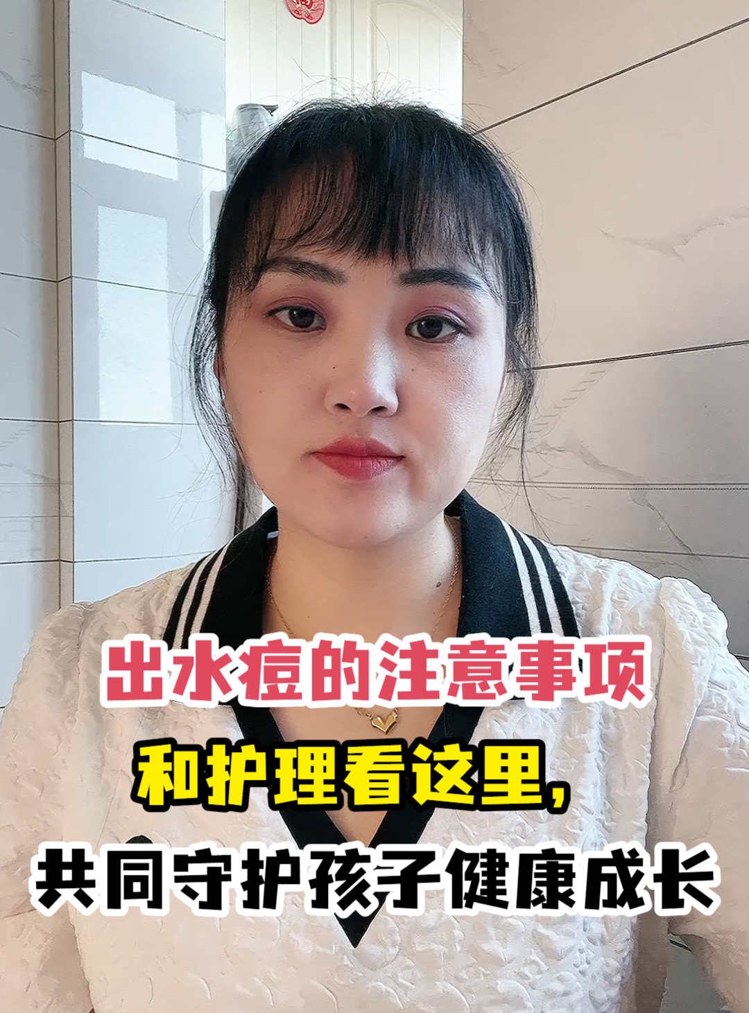 出水痘的<em>注意事项</em>和护理看这里，共同<em>守护</em>孩子健康成长